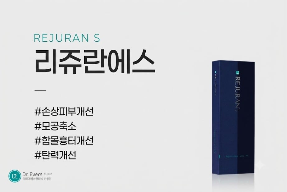 리쥬란S 함몰 흉터 - 닥터에버스 선릉점 선릉피부과