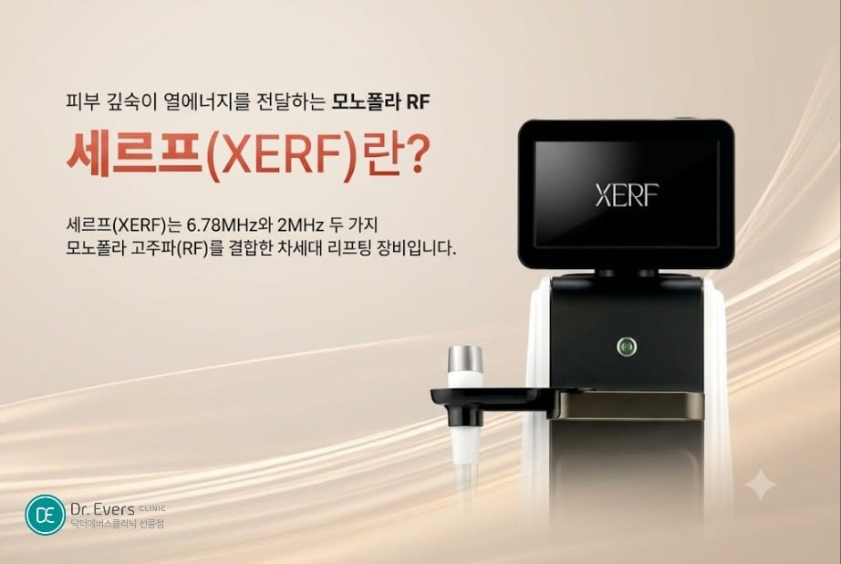 고주파리프팅 종류 세르프리프팅 효과 - 닥터에버스 선릉점 선릉피부과