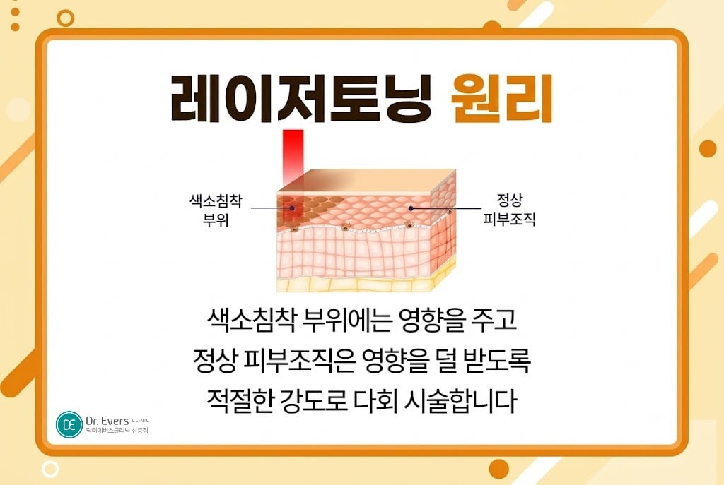 레이저토닝 효과 기미잡티 제거 - 닥터에버스 선릉점 선릉피부과